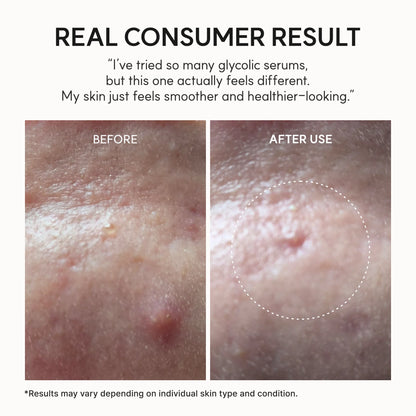 Eraser Shot Glycolic Acid Booster